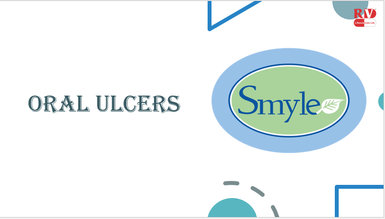 Smyle Gel for Oral Ulcers