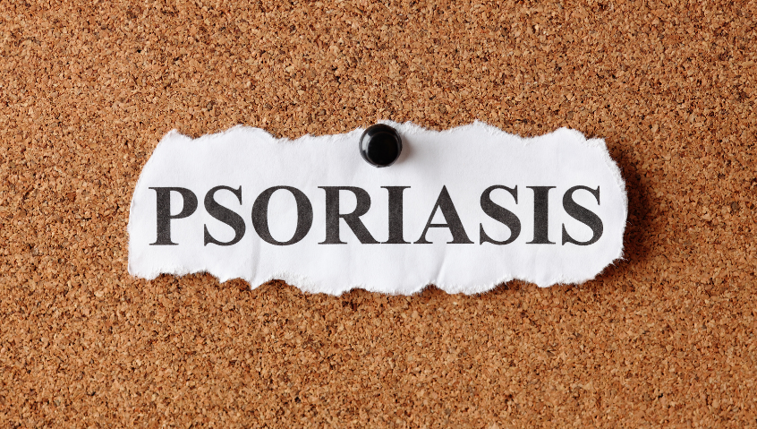 Psoriasis can affect more than your skin