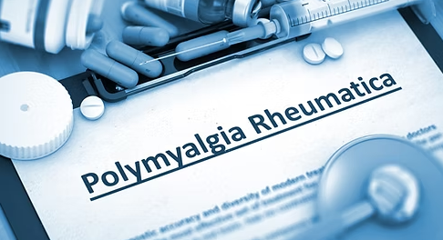 Methotrexate Boosts Steroid-Free Remission in Newly Diagnosed Polymyalgia Rheumatica