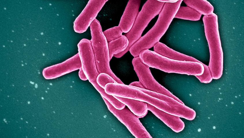 NIH clinical trial of tuberculous meningitis drug regimen begins