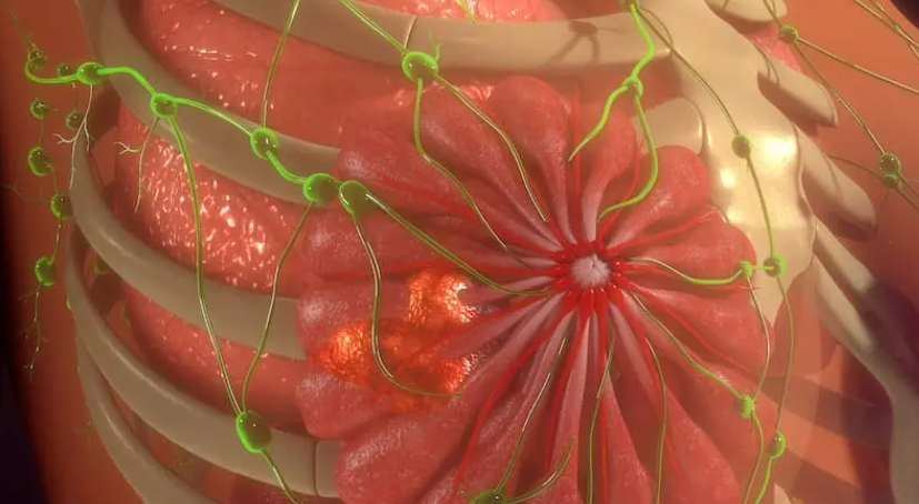Sacituzumab Govitecan + Pembrolizumab: A New First-Line Standard in PD-L1-Positive Metastatic TNBC