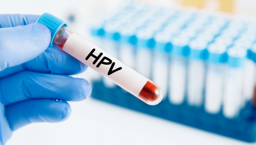 WHO prequalifies additional HPV test