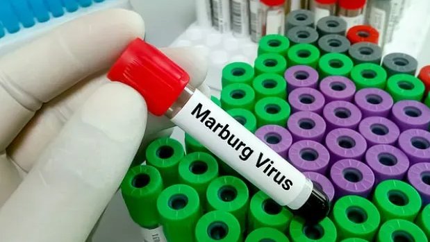 Thành phố Hồ Chí Minh: Ngăn chặn nguy cơ xâm nhập bệnh do virus Marburg