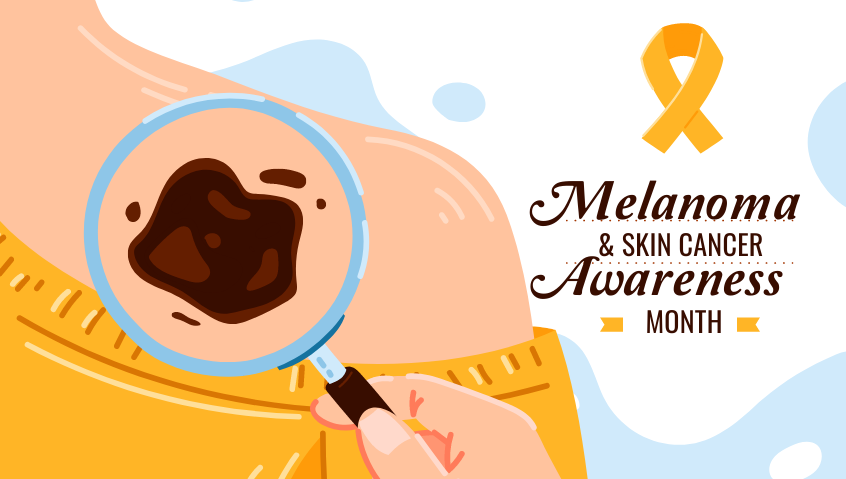 MAY IS SKIN CANCER AWARENESS MONTH