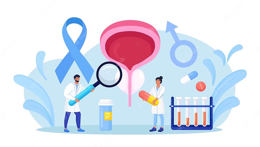 Liệu pháp tiến bộ mới giúp nhắm trúng đích trong ung thư tuyến tiền liệt - PSMA